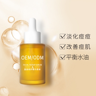 阳江市_祛痘精华原液OEM